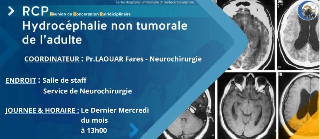 RCP - Hydrocéphalie non tumorale de l'adulte